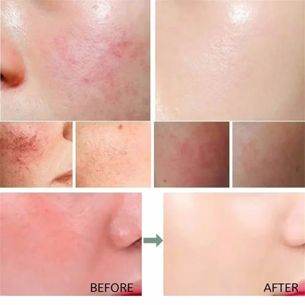 Repair Facial Redness Serum Instant