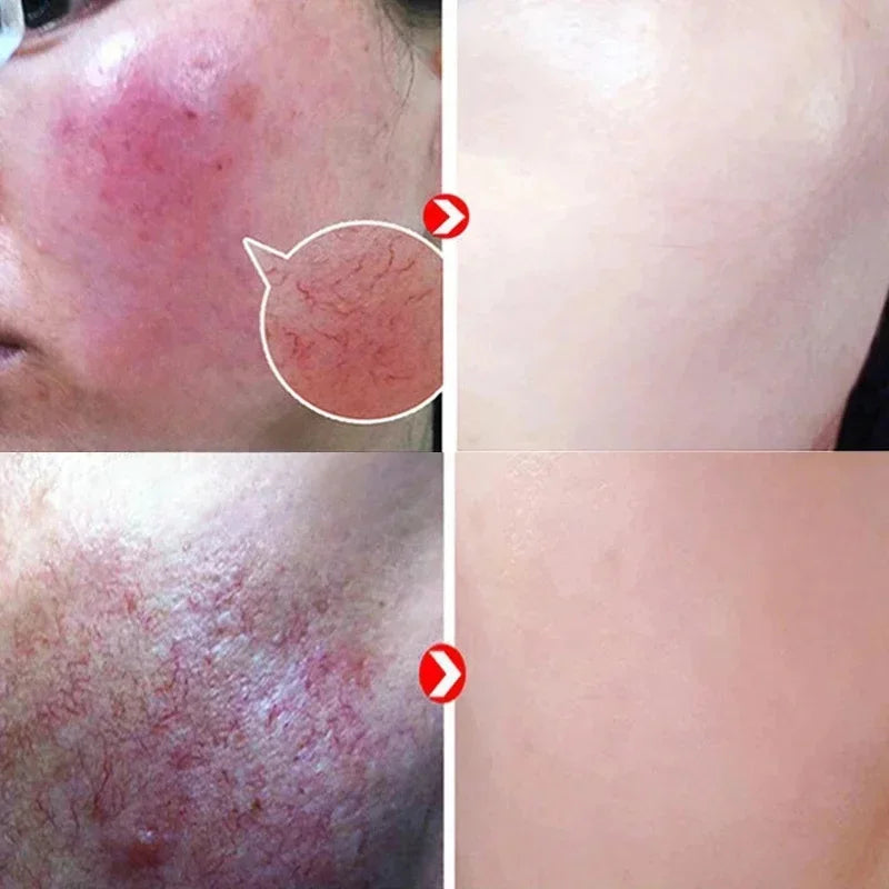 Repair Facial Redness Serum Instant