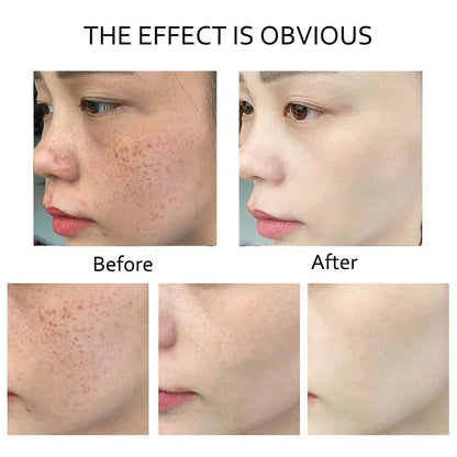 Retinol Serum Anti Wrinkle Fade Dark Spots Vitamin C