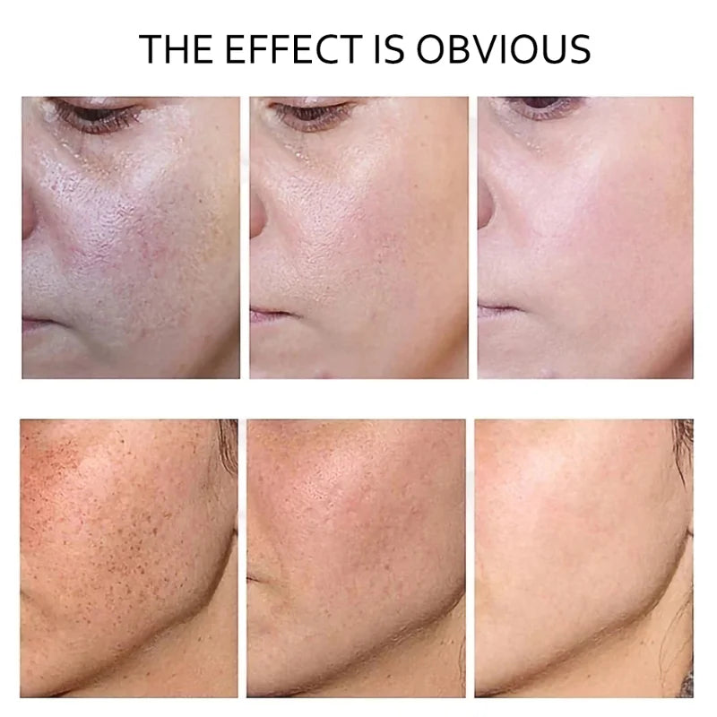 Retinol Serum Anti Wrinkle Fade Dark Spots Vitamin C