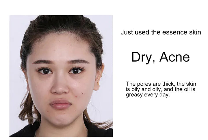 24k Gold Face Serum Brightening Skin Care
