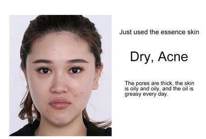 24k Gold Face Serum Brightening Skin Care