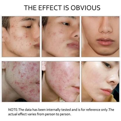 Retinol Serum Anti Wrinkle Fade Dark Spots Vitamin C