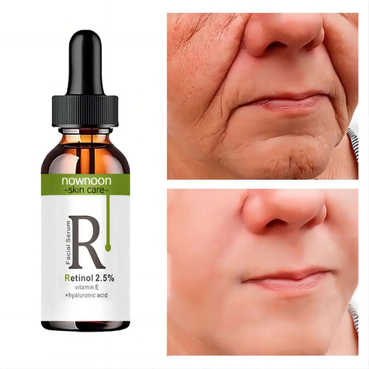 Retinol Serum Anti Wrinkle Fade Dark Spots Vitamin C