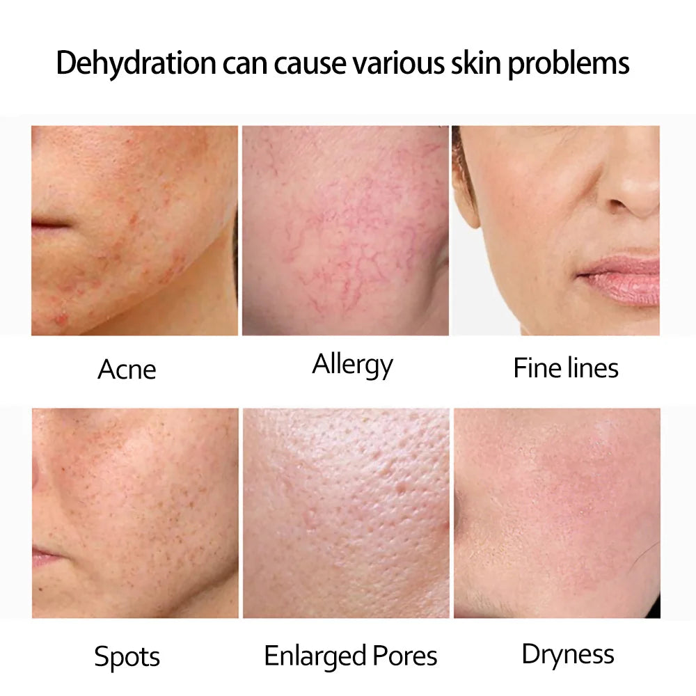 Retinol Serum Anti Wrinkle Fade Dark Spots Vitamin C