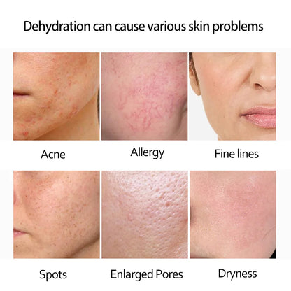Retinol Serum Anti Wrinkle Fade Dark Spots Vitamin C